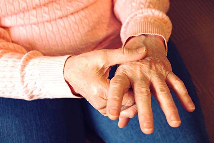 関節リウマチ画像01