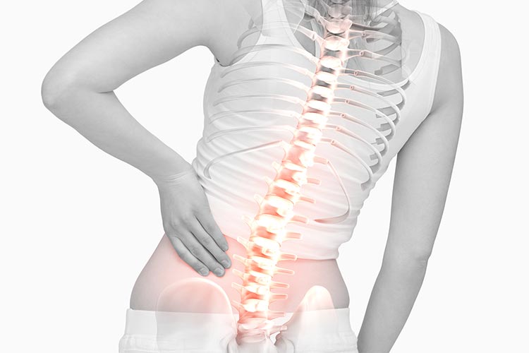 脊椎疾患画像01